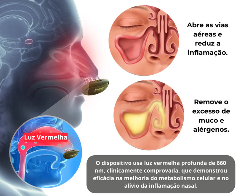 Dispositivo Terapia Nasal de Luz Vermelha RespiRelief™